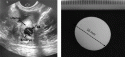 Fig. 3.19