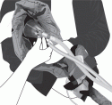 Fig. 10.15