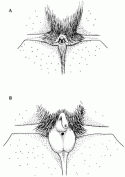 Fig. 13.16